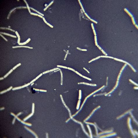 bacillus subtilis negative stain|Preliminary Staining of Bacteria: Negative Stain .